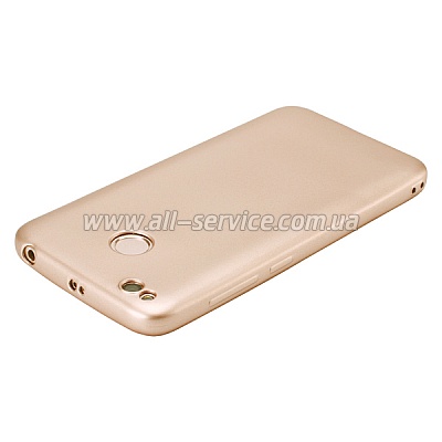 ����� T-PHOX Xiaomi Redmi 4X - Shiny Gold (6361828)